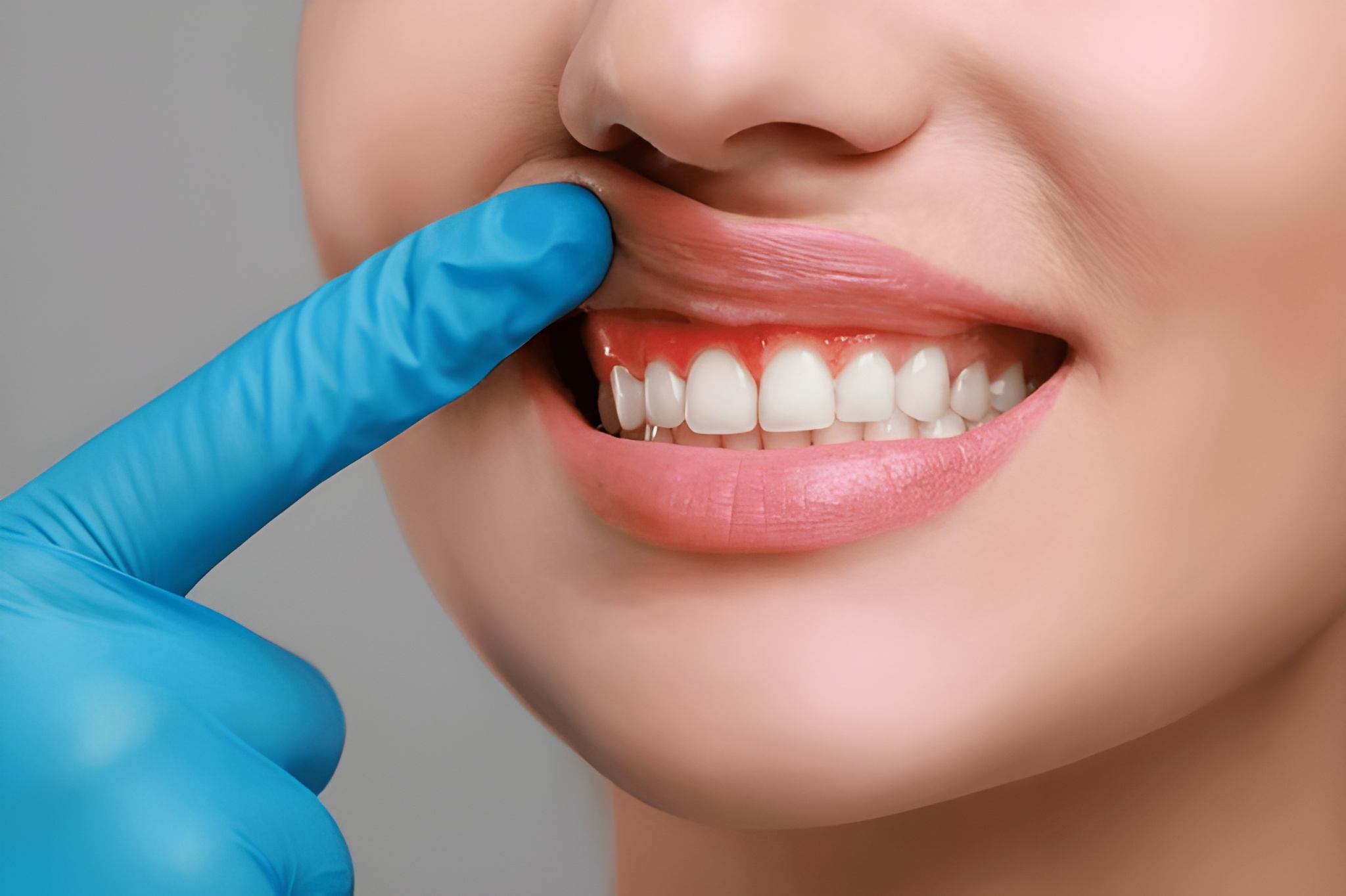 gum disease treatment in midtown toronto