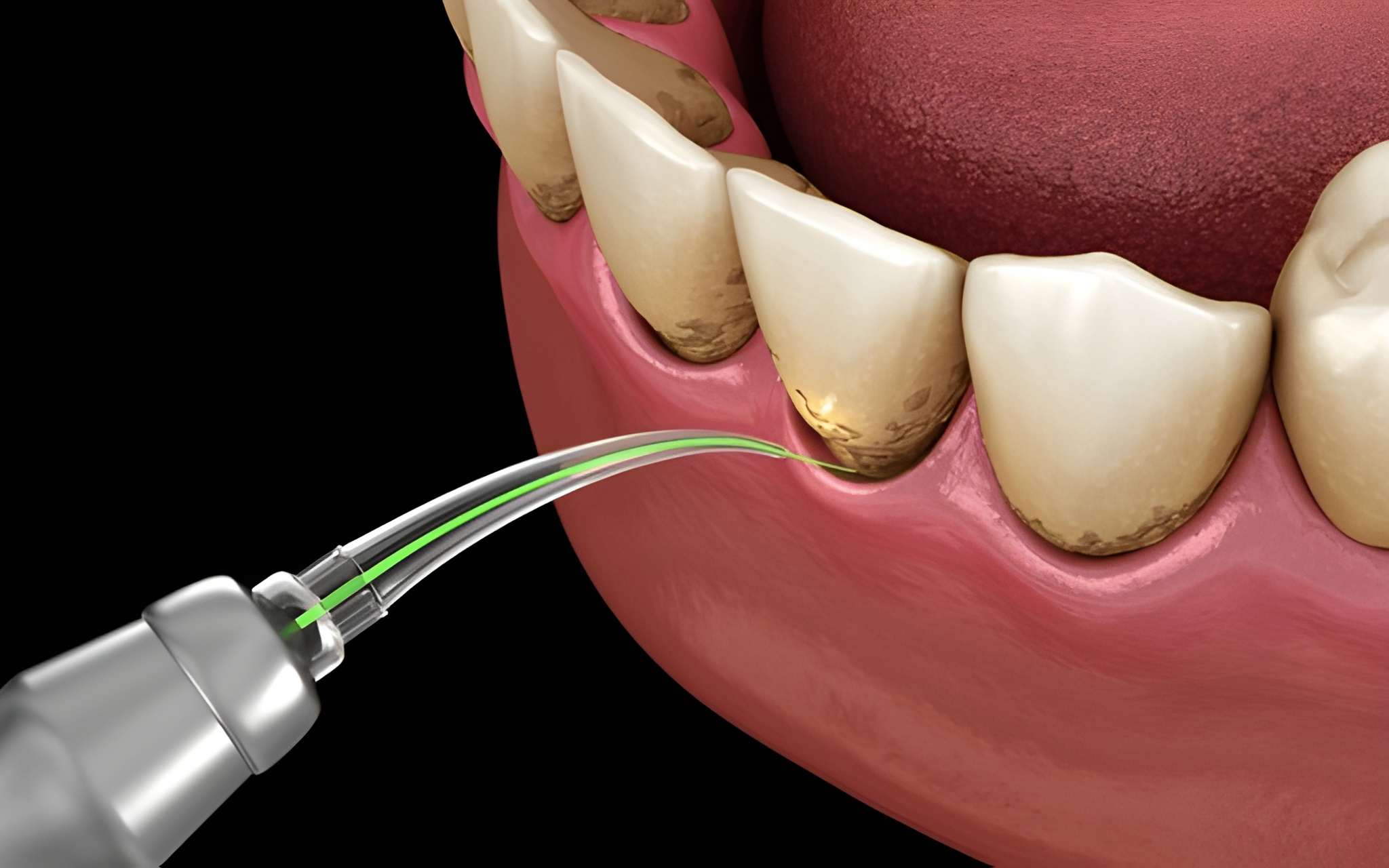 gum disease treatment near you