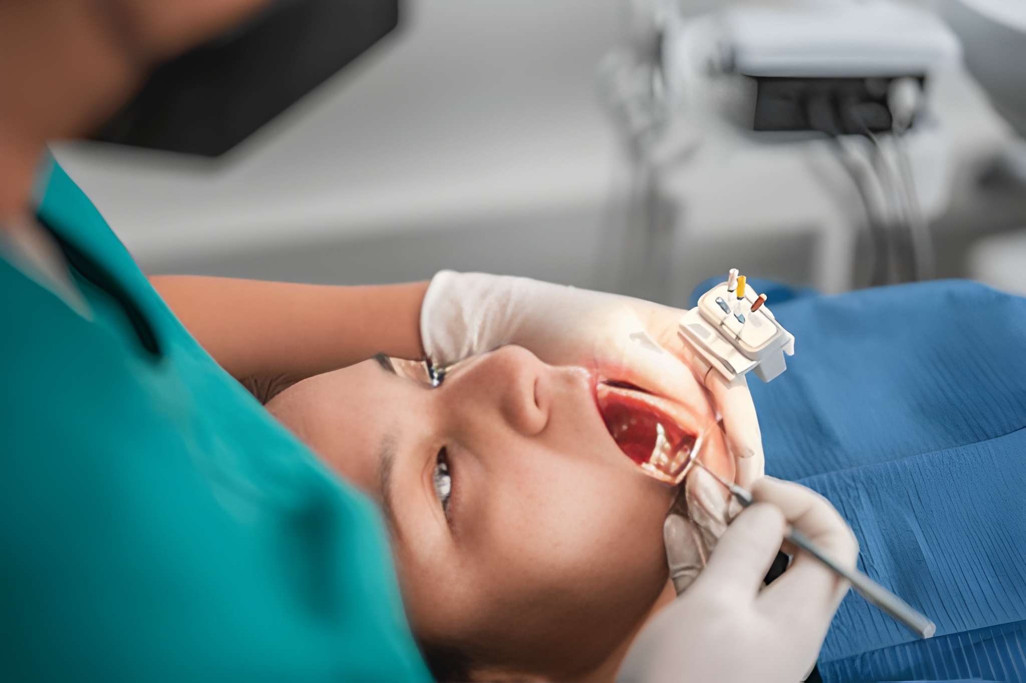 Root canal therapy in Midtown Toronto