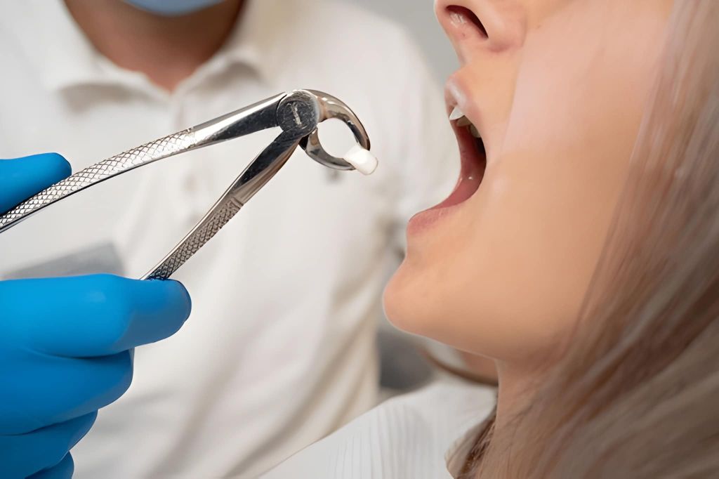 Wisdom teeth removal in Midtown Toronto