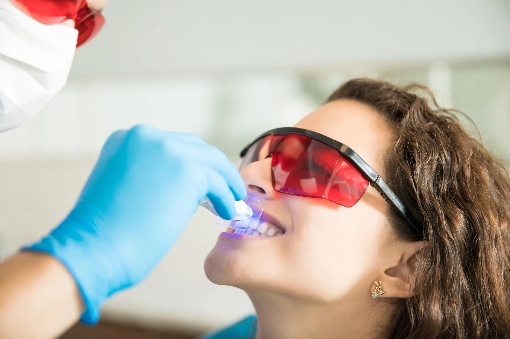 Professional Teeth Whitening vs At-Home Kits: Which Works Better?