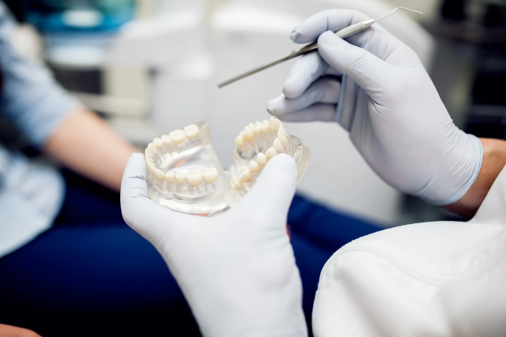 Dental Bridges for Missing Teeth: Benefits Beyond Smile