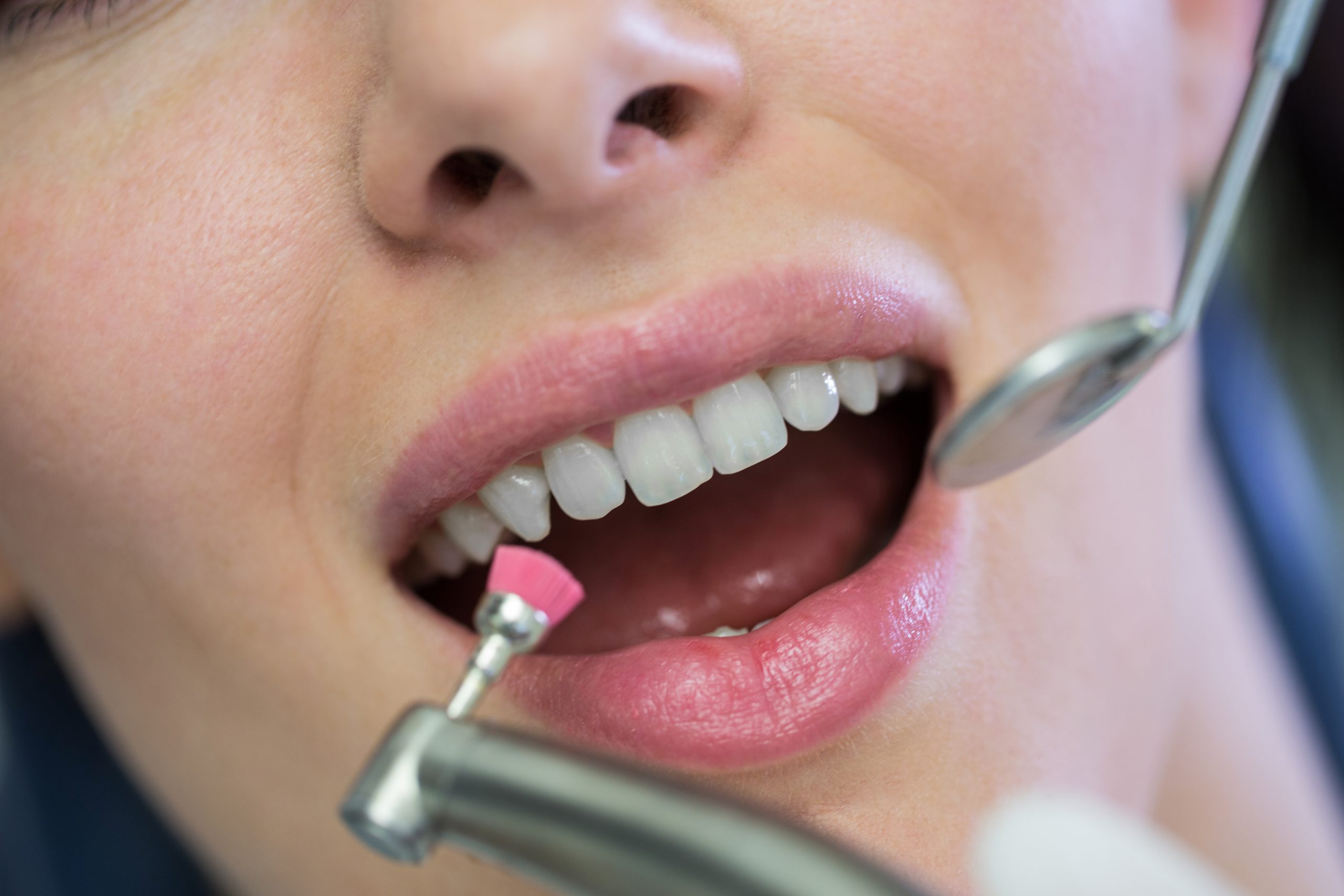 Maintaining Good Oral Health